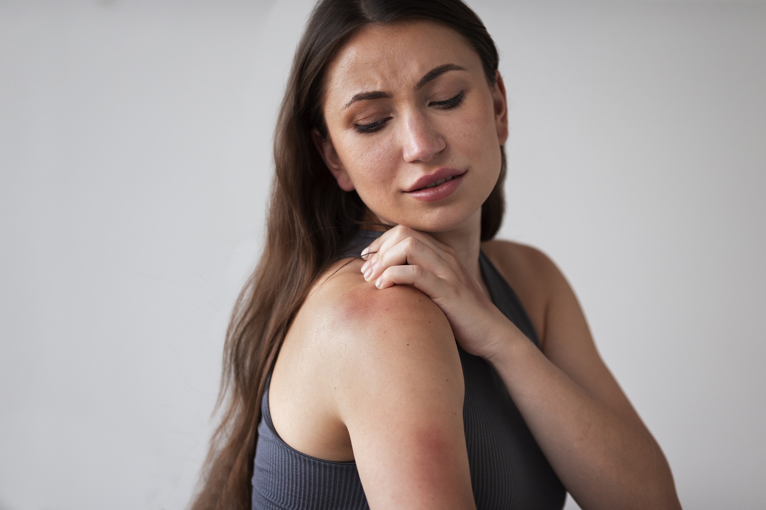 una mujer rascando su hombro con dermatitis seborreica